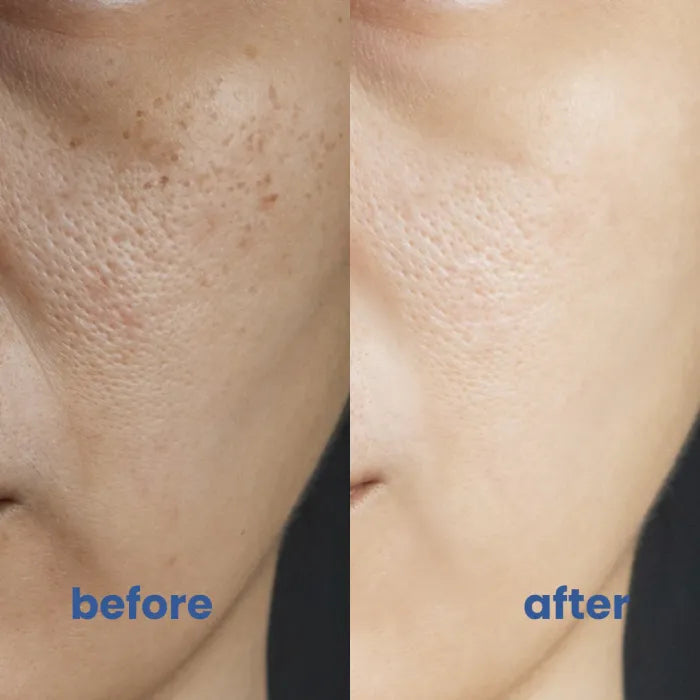 Perfect Coverage solution 4