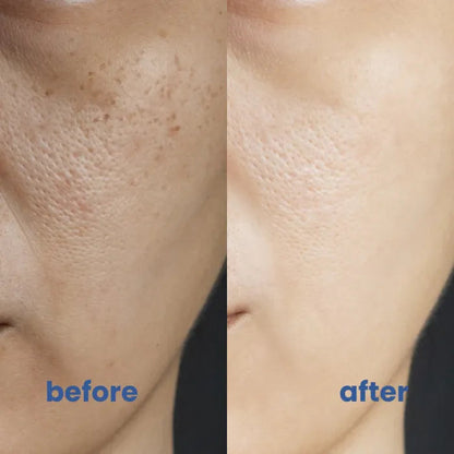 Perfect Coverage solution 4